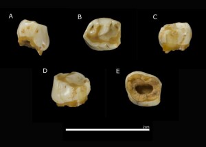 Diente de leche neandertal de Vera 