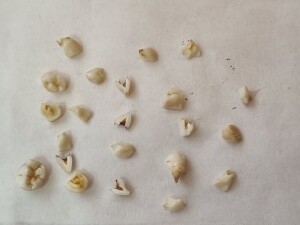 Dientes de la Colección